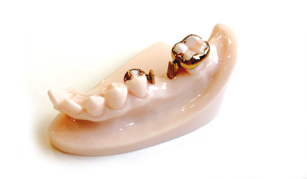 �ڒ��u���b�W�E�q���[�}���u���b�W�E�����s�`�斃�z�\��